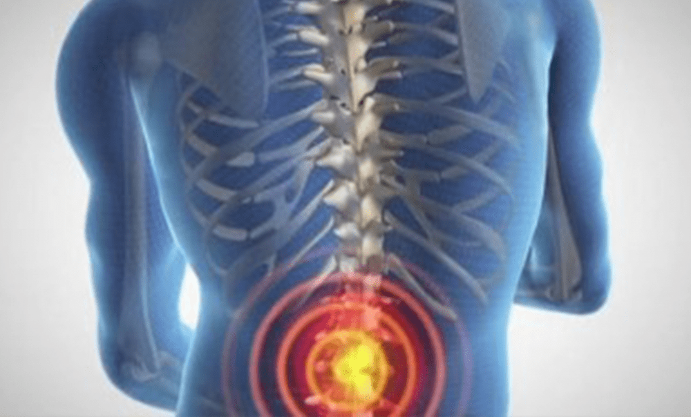 6 Amazing Tips To Keep Your Spine Healthy